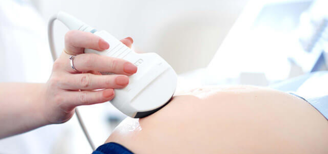 Ultra - SONOGRAPHY